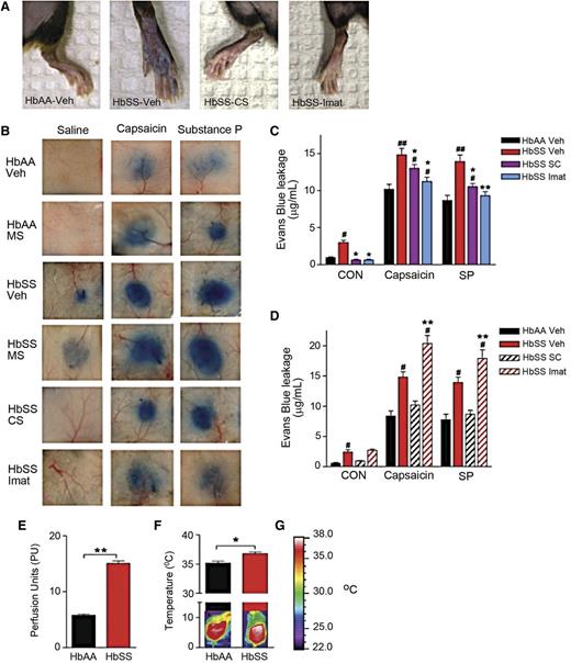 Figure 3. Neurogenic inflammation occurs in SCA. (A-B) Evans blue leakage evoked by injection of saline, capsaicin, or SP in the hind paws (A) and dorsal skin (B) of mice treated with vehicle (saline), morphine sulfate (MS, 10 mg/kg), CS (100 mg/kg), or imatinib (Imat, 100 mg/kg). (C-D) Evans blue leakage. *P < .05, **P < .01 vs HbSS-BERK Veh, #P < .05, ##P < .01 vs HbAA-BERK Veh (ANOVA with Bonferroni). (E) Measures of cutaneous blood flow. **P < .01 (Student t test). (F) Temperature of the dorsal skin of mice with representative thermogram. *P < .05 (Student t test). (G) Calibration bar used.