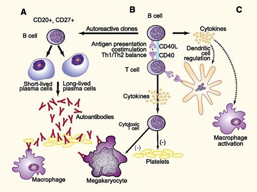 Proposed mechanisms for development of ITP may parallel those generated during vaccine responses. B cells are integral to the immune response in ITP through several mechanisms. These include the production of platelet and megakaryocyte-reactive antibodies (A), as well as antigen presentation (B), in which B-cell–T-cell interactions lead to costimulation resulting in an altered Th1/Th2 balance, clonal expansion of cytotoxic T cells, and release of inflammatory cytokines (C). The latter may stimulate macrophages and dendritic cells, enhancing clearance and destruction of antibody-coated platelets and altering the distribution of T-cell subsets. In the case of ITP, the antigen may be a viral peptide cross-reactive with platelet glycoproteins, platelet glycoproteins themselves following loss of tolerance, or others that have not been characterized. The response to vaccines likely parallels that to platelet glycoproteins depicted here. Adapted from Stasi9 with permission. Professional illustration by Paulette Dennis.