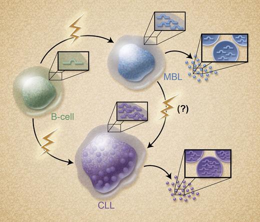 Increased miR-155 expression in MBL, CLL, and CLL poor responders. Approximately 1% to 2% of patients with MBL will develop CLL; however, a direct correlation between MBL and CLL is controversial. Ferrajoli et al report that cellular miR-155 expression increased from B cells to MBL and CLL. Microvesicles secreted from both MBL and CLL also contained miR-155 in increasing amounts. Patients with lower cellular miR-155 expression responded to standard therapies better than those patients with high miR-155 levels. Professional illustration by Alice Y. Chen.