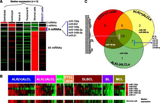 Figure 1. Identification of T-cell–associated miRNA signature. (A) The 6-miRNA signature differentially expressed (P < .01; greater than fourfold change) in normal T cells compared with B-cell subsets and stromal cells. (B) Expression of T-cell miRNA signature in different subtypes of T-cell and B-cell lymphomas. A majority of PTCL cases (including ALK(+) ALCL, ALK(–) ALCL, AITL, and PTCL-NOS) and a few DLBCL cases showed enrichment of T-cell miRNA as well as stromal-cell miRNA signatures. (C) Overlap in the expression of the top 10% of miRNAs from CD3+ T cells, ALK(+) ALCLs, and ALK(–) ALCLs. BL, Burkitt lymphoma; MCL, mantle cell lymphoma.