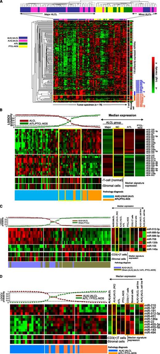 Figure 3. Unsupervised HC of PTCL cases. (A) ALCL cases formed 2 distinct clusters (major and minor HC clusters) with respect to AITLs and PTCL-NOS. ALK(+) ALCL and ALK(–) ALCL cases were interspersed with each other. A group of miRNAs highly expressed in ALCL cases is highlighted (yellow box) and listed on the right side (red bar). A strong stromal signature is represented by the blue bar. (B) miRNA signature associated with ALCL (vs AITL and PTCL-NOS). The Bayesian classifier included 28 miRNAs. Most of the cases in the ALCL minor hierarchical cluster were in the intermediate group. Yellow boxes highlight the minor ALCL group. (C) miRNA signature associated with ALK(+) ALCL. A 7-miRNA classifier was derived by using the Bayesian algorithm, and it included 5 upregulated and 2 downregulated miRNAs. Orange box highlights the expression of this signature among CD3+ normal T cells, stromal cells, and ALCL cell lines. (D) miRNA signature associated with ALK(–) ALCL. An 11-miRNA classifier included 4 upregulated and 7 downregulated miRNAs. Orange box highlights the comparative analysis of this signature in CD3+ normal T cells, stromal cells, and ALCL cell lines. LOOCV, leave-one-out-cross validation; NC, not classifiable.