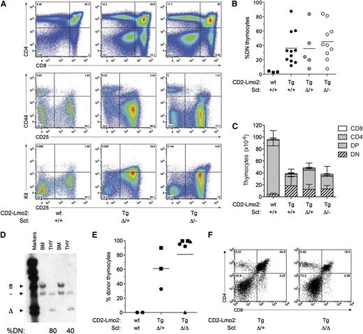 Figure 1. Scl is not required for Lmo2-induced thymocyte self-renewal. (A) Accumulation of immature (CD4-CD8 DN) thymocytes in Lmo2;Lck;SclΔ/– mice. Representative fluorescence-activated cell sorting analysis of total (top panel) and DN thymocytes (center and lower panels) from 2-month-old mice of the indicated genotypes. wt, wild-type; Tg, transgenic). (B) Analysis of the percentage of DN thymocytes in preleukemic mice at 6 months of age. (C) Thymic cellularity of preleukemic mice at 6 months of age. Data represent mean +SD of 3 to 5 mice per group. (D) Scl is effectively deleted in Lmo2;Lck;SclΔ/– thymocytes. Genomic DNA was extracted from the bone marrow (BM) and thymus (THY) of 6-month-old Lmo2;Lck;SclΔ/– mice and used in Southern hybridization to reveal null (–), floxed (fl), and deleted (Δ) Scl alleles. %DN indicates the percentage of DN thymocytes in the thymi analyzed. (E) Scl is not required for long-term engraftment of Lmo2-transgenic thymocytes. Thymocytes were isolated from 2-month-old mice of the indicated genotypes, and thymocytes equivalent to one-quarter of a thymus were injected into sublethally irradiated (6.5 Gy) Ly5.1 recipients. Three weeks later, the proportion of donor thymocytes was determined by flow cytometry. Points represent individual recipient mice, and unique symbols denote separate experiments. (F) Donor thymocytes from recipient mice as in (D) were gated and analyzed for CD4 and CD8 expression by flow cytometry.