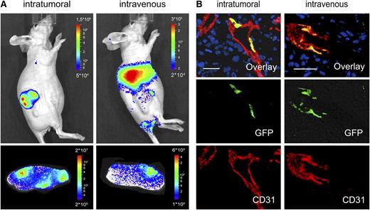 Figure 3. Targeting tumor ECs. Athymic nude mice bearing subcutaneous MCF-7 tumors were injected with either 1 × 106 transducing units intratumorally or 2 × 106 transducing units intravenously with mCD105-LV transferring luciferase (A) or GFP (B). Gene transfer was analyzed 5 days after vector injection by luciferase imaging (A) and histology (B). (A) Luciferase imaging of the whole living animal (upper panel) or in dissected tumor slices (∼2 mm in width, lower panel). (B) On the cellular level, gene transfer was visualized by immunofluorescence of explanted tumors with antibodies specific for mouse CD31 (red, lower panel), GFP (green, center panel), and merge (upper panel). Nuclei in the 9-µm cryosections were stained by DAPI (blue). Scale bar, 30 µm.