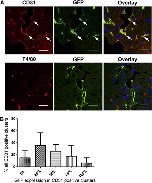 Figure 5. Transduction of human liver EC repopulated mice by huCD105-LV. Rag2−/−yc−/− mice were repopulated with human liver ECs. Two weeks after reconstitution, mice were injected once with 2 × 106 transducing units huCD105-LV. (A) Six to 8 days after vector injection, liver sections were stained for human CD31 (upper panel) or F4/80 (lower panel). Nuclei were stained with DAPI. GFP expression was observed by direct fluorescence. GFP/CD31 double-positive clusters of repopulated human liver ECs are indicated by arrows. Scale bars: 29.63 µm (upper panel) and 27.12 µm (lower panel). No GFP positive cells were detected after administration of huCD105-LV to mice without human liver endothelium (supplemental Figure 8). (B) Because individual human LSECs cannot be identified within the tightly connected clusters in the mouse liver, the amount of GFP-positive cells in the CD31-positive clusters was divided in quintiles of 0%, 25%, 50%, 75%, or 100% GFP expression. The relative quantities of these quintiles are plotted.