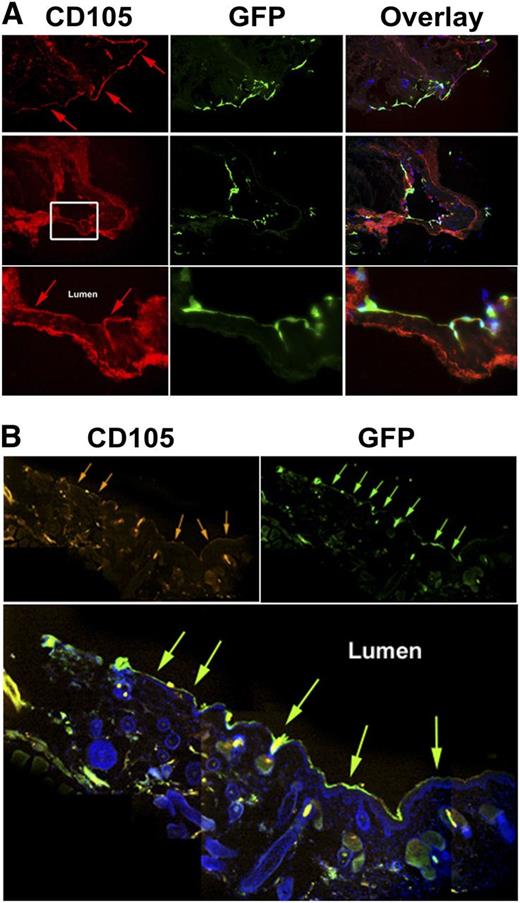 Figure 6. Ex vivo and in vivo transduction of human vessels. (A) Human saphenous veins were removed from patients undergoing coronary bypass surgery and transferred immediately into culture dishes. The vessels were transduced with huCD105-LV and cultivated for 7-10 days before fixation and immunofluorescent staining. Cells were stained for human CD105 (left column) or for GFP (middle column), or were merged to display colocalization (right column). Arrows point to the luminal side of the vessel. (B) Mammarian arteries from patients requiring coronary bypass surgery were transplanted intraabdominally into the descending aorta of NOD Rag2−/−IL-2Rγcnull mice. HuCD105-LV (3 × 107 transducing units) was injected into the tail vein of transplanted mice at 2, 5, and 8 days after transplantation, and mice were sacrificed after 16 days. The transplanted artery was cryosectioned and prepared for immunofluorescence staining. The pictures were acquired by detecting fluorescence at 4 adjacent locations along the luminal endothelial layer of the transduced graft. Raw picture data were obtained by acquiring fluorescence in the GFP, the DAPI, and the Cy5 channel. The channels were merged using the Olympus Cell^M image acquiring and processing software. To obtain an overview of the entire stretch of the transduced endothelium, we assembled 4 pictures using Adobe Photoshop software (Adobe Systems, San Jose, CA). Hangover areas were filled with black color to generate a high-contrast background. Noise was reduced by balancing color levels equally for assembled pictures. The staining revealed CD105-positive cells lined up facing the lumen (orange arrows, top left), which were also positive for GFP (green arrows, top right). Colocalization is depicted in the merge (bottom, green arrows). Representative pictures are from 1 mouse, 3 mice transplanted.