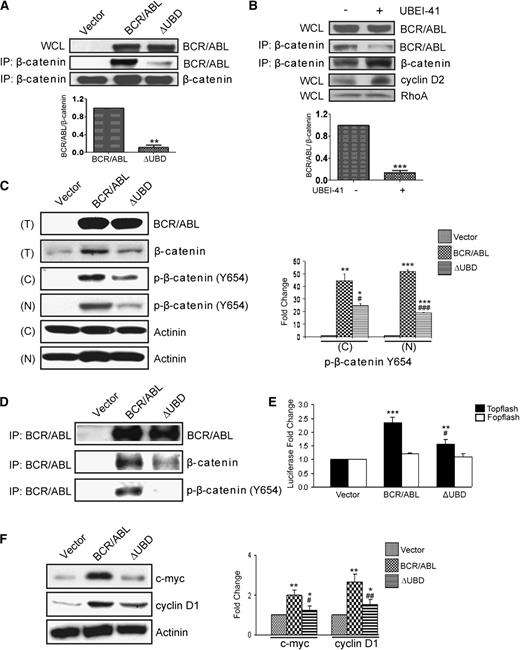 Figure 2. Deletion of the β-catenin binding site in p210 BCR/ABL diminishes the accumulation of p-β-catenin (Tyr654) and TCF/LEF-mediated transcription. (A) 293T cells were transiently transfected with p210 BCR/ABL (BCR/ABL), the ΔUBD mutant, or cognate vector. WCLs were collected and examined by western blot for expression of the constructs. Lysates were also used for IPs using a β-catenin antibody, and immunoprecipitates were examined by western blot using antibodies for β-catenin and p210 BCR/ABL. (B) 293T cells were transfected with p210 BCR/ABL in the presence or absence of the E1 inhibitor. WCLs were collected and examined by western blot for expression of p210 BCR/ABL (BCR/ABL), cyclin D2, or RhoA. Lysates were also used for IPs using a β-catenin antibody, and immunoprecipitates were examined by western blot using antibodies for β-catenin and BCR/ABL. (C) Ba/F3 cells were infected with retroviral particles that encode MSCV-bcr-abl/p210-IRES-gfp (BCR/ABL), MSCV-bcr-abl/p210(ΔUBD)-IRES-gfp (ΔUBD), or cognate vector. GFP+ cells were then sorted and cultured. Total cell lysates (T) were collected and examined by western blot for expression of the constructs and β-catenin. Nuclear (N) and cytosolic (C) lysates were prepared and examined by western blot as indicated. Quantified data for p-β-catenin (Tyr654) expression are shown on the right. (D) WCLs were also used for IPs using a BCR/ABL antibody, and immunoprecipitates were examined by western blot using antibodies for β-catenin and BCR/ABL as indicated. (E) TOP- and FOPflash plasmids were transfected into the stably infected Ba/F3 cells. Twenty-four hours after transfection, cells were analyzed for luciferase activity. (F) WCLs from stably infected Ba/F3 cells were examined by western blot for expression of cyclin D1 and c-Myc. All quantitative data shown are averages ± standard deviations of at least 3 independent experiments. P values were calculated by using a paired Student t test or a one-way ANOVA followed by Tukey tests. *,#P < .05; **,##P < .01; ***,###P < .001. *Indicates significance relative to vector; #indicates significance relative to p210 BCR/ABL.