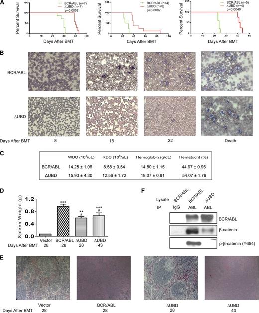 Figure 3. β-catenin binding contributes to disease progression in a BMT model for CML. (A) Survival of mice transplanted with p210 BCR/ABL or p210 BCR/ABL(ΔUBD). Kaplan-Meier curves were generated from 3 independent experiments as indicated. Mantel-Cox tests of the 3 survival curves yielded values of P = .0002 (χ2 = 13.5), P = .0002 (χ2 = 13.9), and P = .0046 (χ2 = 8.0), respectively. (B) Blood smears were performed weekly to monitor disease progression. (C) Results of complete blood counts performed at death. Data shown represent an average of 3 mice and are presented with standard deviations. (D) Spleens that were harvested at time of death were weighed. P values were calculated by using a one-way ANOVA followed by Tukey tests. (E) Spleens were harvested at the indicated times, and processed slides were stained with hematoxylin and eosin. Images were visualized by using a Nikon Eclipse 50i microscope (Nikon, Tokyo, Japan) equipped with a 10×/0.25 numerical aperture and were acquired by using a Go-5 camera (QImaging, Surrey, Canada) and QCapture Pro 6.0 software. (F) WCLs were prepared from spleens collected at time of death. Lysates were immunoprecipitated with a BCR/ABL antibody and examined by western blot as indicated. IgG indicates normal rabbit IgG-conjugated agarose; Abl indicates agarose-conjugated anti-abl antibody. **P < .01; ***P < .001 compared with vector; #P < .05 compared with p210 BCR/ABL.