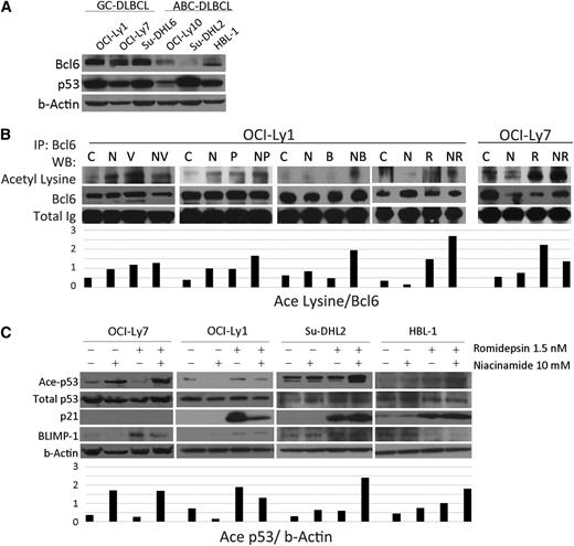 Figure 3. Acetylation of Bcl6 and p53 in DLBCL lines after treatment with niacinamide and pan-class I/II DAC inhibitor. (A) Western blot analysis of Bcl6 and p53 in 6 untreated DLBCL cell lines. Bcl6 is expressed to a greater degree in GC- over ABC-subtype DLBCL. (B) Acetylation of Bcl6 in 2 GC-derived DLBCL cell lines treated for 3 hours with niacinamide (N), 10 mM, and/or 1 of 4 pan-class DAC inhibitors: vorinostat (V), 3 uM; panobinostat (P), 15 nM; belinostat (B), 600 nM; or romidepsin (R), 6 nM for OCI-Ly1 and 1.5 nM for OCI-Ly7. Whole cell lysates were analyzed by immunoprecipitation for Bcl6 and Western blot analysis for acetyl lysine. Densitometry analysis was performed on scanned immunoblot images using the ImageJ software (National Institutes of Health). Relative levels of acetylated-Bcl6 were calculated and plotted. (C) Western blot analysis of acetylated-p53, total p53, p21, and Blimp1 in 4 DLBCL cell lines treated with 10 mM niacinamide, 1.5 nM romidepsin, or the combination for 24 hours. OCI-Ly7 does not express p21 at measurable levels at baseline.