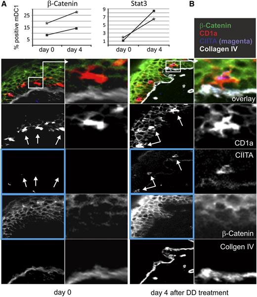 Figure 3. DD treatment induces increased expression of β-catenin and CIITA in skin tissue (see also supplemental Figure 8). (A) PBMC from patients #19 and #21 (3 × 12 μg/kg; see also supplemental Figure 1) were stained for intracellular β-catenin and Stat-3 on day 0 and day 4 after DD treatment, and mDC1 were analyzed by FACS. (B) Tissue sections (cryosections) of healthy skin obtained from patient #19 (see results for patient #21 in supplemental Figure 8) on day 0 and day 4 were stained side by side using MELC robots as described previously16 and the indicated directly labeled fluorescein isothiocyanate–conjugated antibodies. Digital images were obtained at 20-fold magnification. The main differences are seen in the expression levels of CIITA and β-catenin (blue boxed images, details in text). White arrows depict epidermal Langerhans cells not expressing (day 0) or expressing CIITA (day 4). β-Catenin showed enhanced expression on day 4; note the appearance of the protein in the cytoplasm of skin cells. Pixel intensities of images of the same tissue section, representing expression levels of proteins, were adjusted relative to the expression level of collagen IV, which served as a control.