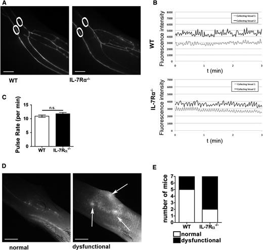 Figure 7. IL-7Rα deficiency does not affect the pumping activity of lymphatic collectors but impairs uptake and transport in lymphatic initials. IL-7Rα−/− or WT mice (n = 7/genotype) were injected with a near-infrared dye (IRDye680) 20-kDa PEG conjugate into the hind paw and LVs in the upper and lower limb were examined under a stereomicroscope. (A) Representative images of the collecting LVs in the lower limb of an IL-7Rα−/− and a WT mouse. White circles indicate the region of the 2 collecting vessels in which pulse rates were analyzed. (B) Representative plots of the pulse rates measured in the 2 collecting vessels of a WT and an IL-7Rα−/− mouse. (C) Quantification of the collecting LV contractility revealed no difference in pulse rates between IL-7Rα−/− and WT mice (n = 7 mice/genotype). (D) Representative images of normal and dysfunctional lymph flow in the dorsal paw skin (upper limb) located proximal to the dye injection site. Under normal conditions (left), only deeper collecting vessels filled with dye are visible. By contrast, lymphatic dysfunction (right) is characterized by increased dye spreading through the initial lymphatic capillaries with evidence of leakage (white arrows). (E) Quantification of normal (white) and dysfunctional (black) lymphatic drainage in the dorsal paw skin proximal to the injection site (n = 7 mice/genotype). Scale bar represents 1 mm.
