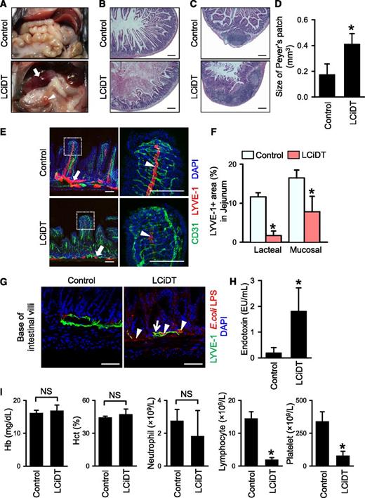 Figure 2. Major phenotypes of LYVE-1-Cre/iDTR mice after DT administration. Comparisons between control and LCiDT for major findings at 24 hours after DT administration. Each group, n = 4 to 5. *P < .05. (A) Gross images of the abdominal contents. The arrow indicates a hemorrhagic and swollen duodenum, and the arrowhead indicates a hyperemic and enlarged Peyer patch. (B-C) Duodenums and Peyer patches in jejunums stained with hematoxylin and eosin. Scale bars, 200 μm. (D) Quantification of sizes of Peyer patch. (E) LYVE-1+ lymphatic vessels and CD31+ blood vessels in jejunums. Indicated areas (square with white dotted line) are magnified in the right panels. The arrows indicate mucosal lymphatic vessels, and the arrowheads indicate lacteal lymphatic vessels. Scale bars, 100 μm. (F) Quantification of LYVE-1+ area in the jejunum. (G) Images showing abundant distribution of LPS derived from E coli at the base of the villi (arrowheads) and within LYVE-1+ mucosal lymphatic vessels (arrow) of the LCiDT mice at 24 hours after DT administration, whereas LPS is rarely detected in the control mice. 4,6 Diamidino-2-phenylindole (DAPI) staining for nuclei. Scale bars, 50 µm. (H) Serum endotoxin levels. (I) Blood profiles of hemoglobin, hematocrit, neutrophils, lymphocytes, and platelets. NS, not statistically significant.