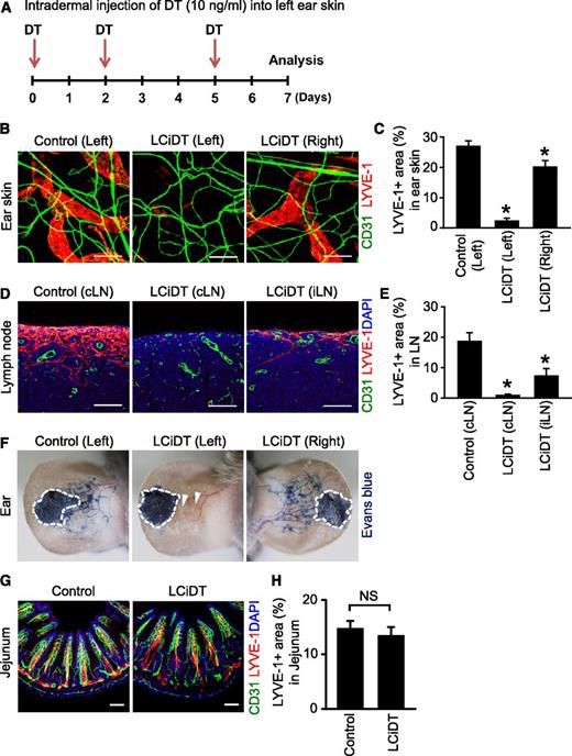 Figure 6. Local ablation of lymphatic vessels after intradermal injection of DT into the ear skin. (A) Diagram of experimental scheme for local lymphatic ablation by intradermal injection of DT (10 ng/mL) into the left ear skin of LCiDT mice. Samples were harvested at 7 days after triple injections of DT. (B) Images showing LYVE-1+ lymphatic vessels and CD31+ blood vessels in the left and right ear skins of LCiDT and control mice. Scale bars, 100 μm. (C) Quantifications for LYVE-1+ area in the ear skins. Each group, n = 4. *P < .05 vs control. (D) Images showing LYVE-1+ lymphatic vessels in draining cervical lymph node (cLN) and distal inguinal lymph node (iLN) of LCiDT and control mice. Scale bars, 100 μm. (E) Quantifications for LYVE-1+ area in the LNs. Each group, n = 4. *P < .05 vs cLN of control. (F) Lymphatic drainage of Evans blue dye in the ear skins. The dotted line shows the Evans blue injection site. The arrowhead indicates no lymph drainage. Similar findings were observed in 3 to 4 different mice. (G) Images showing LYVE-1+ lymphatic vessels in jejunums. Scale bars, 100 μm. (H) Quantifications for LYVE-1+ area in the jejunums. Each group, n = 4. NS, not statistically significant. DAPI, 4,6 diamidino-2-phenylindole.