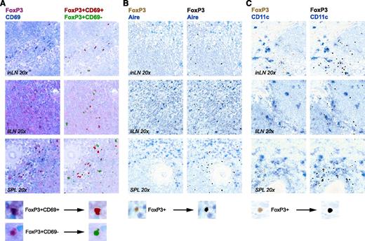 Figure 4. Immunohistochemistry of FoxP3pos cells in human secondary lymphoid organs. Immunohistochemistry of representative specimens of human liLNs, inLNs, and SPL samples. (A) Anti-FoxP3 (magenta) and anti-CD69 (blue) staining (magnification, ×20). (Left panel) Photo image. (Right panel) Composite image with pseudocolor: FoxP3posCD69pos (red) and FoxP3posCD69neg (green). (B-C) Anti-FoxP3 (brown) and anti-Aire (blue) (B) or anti-CD11c (blue) (C). (Left panel) Photo image. (Right panel) Composite image with pseudocolor: FoxP3pos (black). A representative digital magnification of the composite image procedure to generate pseudocolors in ImageJ is shown on the bottom.