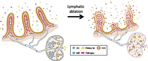 Lymphatics in the intestinal villi and lymph nodes protect us from sepsis. Jang et al1 showed that ablation of intestinal lymphatics and lymph node lymphatics compromises the architecture of the surrounding tissues, including neighboring blood vessels, and leads to infiltration of the intestinal gut flora into the system, causing a systemic infection followed by fatal inflammatory responses, collectively called sepsis. See Figure 7 in the article by Jang et al that begins on page 2151.