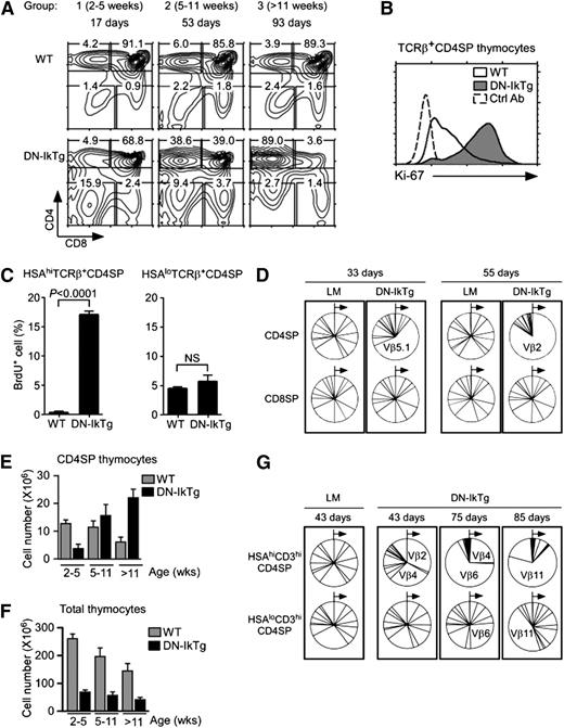 Figure 3. Clonal expansion of CD4SP cells in DN-IkTg thymocytes. (A) Thymocyte profiles of DN-IkTg mice with progressing age. Contour plots show representative CD4/CD8 thymocyte profiles of WT and DN-IkTg mice at different ages. Data are representative of at least 5 independent experiments with 21 WT and 27 DN-IkTg mice. (B) Intracellular Ki-67 staining in TCRβ+CD4SP thymocytes. Data are representative of 3 independent experiments with 4 WT and 6 DN-IkTg mice. The histogram shows data from 49-day-old WT and 80-day-old DN-IkTg mouse. (C) BrdU labeling assays of WT and DN-IkTg thymocytes. BrdU incorporation was determined in immature (HSAhiTCRβ+) and mature (HSAloTCRβ+) CD4SP thymocytes by intracellular staining. Data are the summary of 2 independent experiments with 3 WT mice (two 55 days old and one 58 days old) and 4 DN-IkTg mice (45, 62, 62, and 82 days old). (D) TCR Vβ distribution in CD4SP and CD8SP thymocytes. LM and DN-IkTg thymocytes were stained for a panel of 15 different TCR Vβ segments starting from Vβ2 through Vβ17a in a clockwise direction (see Methods). Relative expression of individual TCR Vβ on CD4SP and CD8SP cells are shown in pie charts for each individual mouse. Each pie chart represents an independent experiment. Data show the representative results from 2 independent experiments with each 1 age-matched (33 and 55 days old) WT and DN-IkTg mouse, respectively. (E) CD4SP thymocyte numbers in WT and DN-IkTg mice with progressing age. CD4SP cell numbers were determined in 3 different age groups of WT and DN-IkTg mice: group 1 (2-5 weeks), group 2 (5-11 weeks), and group 3 (>11 weeks). Data represent the summary of at least 4 independent experiments with 17 WT and 23 DN-IkTg mice. Bar graphs represent mean ± SEM. (F) Total thymocyte numbers of WT and DN-IkTg mice with progressing age. Thymocyte numbers were determined in the indicated age groups with 21 WT and 27 DN-IkTg mice. Data show the summary of at least 5 independent experiments and represent the mean ± SEM. (G) TCR Vβ distribution in HSAhi and HSAloCD3hiCD4SP thymocytes. Indicated thymocyte populations from LM and DN-IkTg mice were stained for a panel of 15 different TCR Vβ segments whose relative distributions are shown in pie charts. Each box indicates analyses from a single mouse.