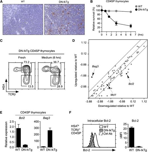 Figure 4. Massive apoptosis of DN-IkTg CD4SP thymocytes. (A) TUNEL assay of WT and DN-IkTg thymus sections. Upon TUNEL staining, thymus tissue sections were counterstained with hematoxylin and eosin. Histology slides show results from a 93-day-old WT and a 94-day-old DN-IkTg mouse and are representative of 3 independent experiments (original magnification ×10) for a total of 3 WT and 3 DN-IkTg mice. (B) Survival kinetics of DN-IkTg CD4SP thymocytes in vitro. Cell viabilities were determined by propidium iodide exclusion at indicated time points during in vitro culture. Data show the summary of 3 independent experiments with each 1 WT and 2 DN-IkTg mice, respectively. (C) Phenotype analysis of apoptosis-resistant DN-IkTg CD4SP cells. Freshly isolated DN-IkTg thymocytes were incubated in medium for 6 hours and then assessed for cell survival. Propidium iodide staining–negative cells were analyzed for their CD4/CD8 profiles and HSA/TCRβ expression. Contour plots are representative of 2 independent experiments with 3 WT and 4 DN-IkTg mice. (D) Apoptosis pathway gene array analysis of DN-IkTg CD4SP thymocytes. Total RNA from sorted WT or DN-IkTg CD4SP cells were used to probe an apoptosis PCR array for expression of pro- and antiapoptotic genes. Data are representative of 3 independent experiments using sorted CD4SP thymocytes with each 1 WT and 1 DN-IkTg mouse. (E) qRT-PCR analysis of potential Ikaros target gene expression from sorted CD4SP thymocytes. Data are the mean ± SEM of 3 independent experiments with a total of 3 WT and 4 DN-IkTg mice. (F) Intracellular Bcl-2 expression in HSAhiCD3hiCD4SP. Freshly isolated DN-IkTg thymocytes were assessed for Bcl-2 expression. The histogram is representative of, and the bar graph displays, the mean ± SEM of 2 independent experiments with each 1 WT and 2 DN-IkTg mouse.