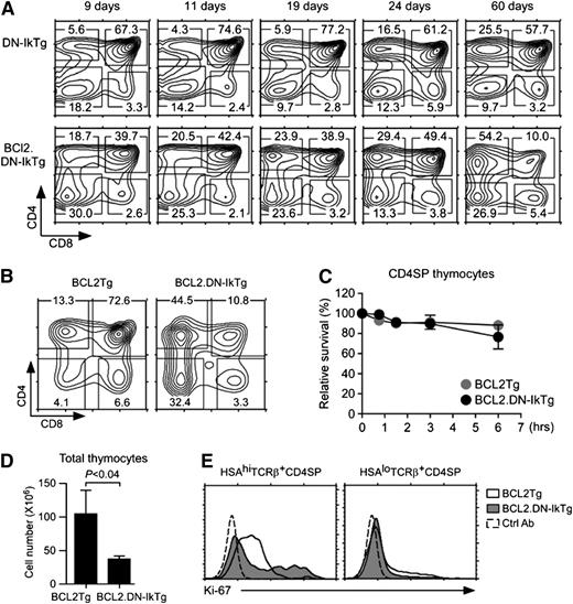 Figure 5. Transgenic Bcl-2 rescues programmed cell death but fails to restore T-cell development in DN-IkTg mice. (A) Thymocyte profiles of BCL2.DN-IkTg mice with progressing age. Contour plots show CD4/CD8 profiles of BCL2.DN-IkTg and control DN-IkTg thymocytes at the indicated age. (B) Thymocyte profiles of BCL2Tg and BCL2.DN-IkTg mice. Contour plots show CD4 vs CD8 profiles of total thymocytes. Contour plots are from age-matched mice (81 days old) and are representative of 4 independent experiments with 4 BCL2Tg and 7 BCL2.DN-IkTg mice. (C) Survival kinetics of BCL2.DN-IkTg CD4SP thymocytes in vitro. Cell viabilities were determined by propidium iodide exclusion at the indicated time points. Data show the summary of 2 independent experiments with 2 BCL2Tg and 3 BCL2.DN-IkTg mice. (D) Total thymocyte numbers of BCL2Tg and BCL2.DN-IkTg mice. Bar graphs show the mean ± SEM of at least 4 independent experiments with 4 BCL2Tg and 7 BCL2Tg.DN-IkTg mice. (E) Intracellular Ki-67 staining in HSAhi and HSAloTCRβ+ CD4SP thymocytes. Data are representative of 4 independent experiments.