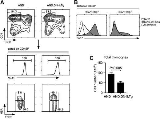 Figure 6. AND TCR transgene fails to rescue developmental arrest of DN-IkTg CD4SP thymocytes. (A) Thymocyte profiles of AND and AND.DN-IkTg mice. Total thymocytes were assessed for CD4/CD8 expression, and TCR Vα11 expression was determined on gated CD4SP cells. HSA and TCRβ expression was assessed on Vα11hi CD4SP thymoycytes. Data are representative of at least 7 independent experiments with 7 AND and 9 AND.DN-IkTg mice. (B) Intracellular Ki-67 staining in HSAhi and HSAlo TCRβ+ CD4SP thymocytes of AND and AND.DN-IkTg mice. Data are representative of 3 independent experiments. (C) Total thymocyte numbers from AND and AND.DN-IkTg mice. The graph shows the mean ± SEM from 7 independent experiments with 7 AND and 9 AND.DN-IkTg mice.
