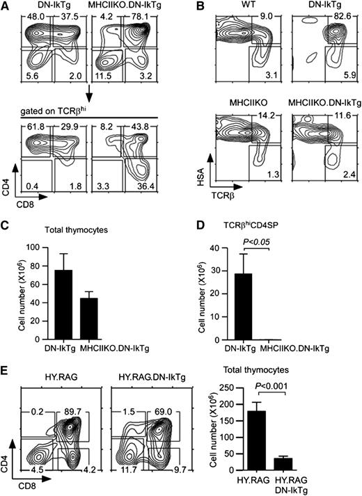 Figure 7. Clonal expansion of postselection CD4+CD8lo intermediate cells in DN-IkTg thymocytes. (A) Thymocyte profiles of DN-IkTg and MHCIIKO.DN-IkTg mice. Contour plots show CD4/CD8 profiles of total and TCRβhi-gated thymocytes. Data are representative of 5 independent experiments with 6 DN-IkTg and 5 MHCIIKO.DN-IkTg mice. (B) Thymocyte differentiation in MHCIIKO.DN-IkTg mice. HSA vs TCRβ profiles of WT, DN-IkTg, MHCIIKO, and MHCIIKO.DN-IkTg mice. Data are representative of 4 independent experiments with 4 WT, 6 DN-IkTg, 5 MHCIIKO, and 5 MHCIIKO.DN-IkTg mice. (C) Total thymocyte numbers of DN-IkTg and MHCIIKO.DN-IkTg mice. The bar graph shows the mean ± SEM from 3 independent experiments with 10 DN-IkTg and 5 MHCIIKO.DN-IkTg mice. (D) TCRβhi CD4SP thymocyte numbers of age-matched DN-IkTg and MHCIIKO.DN-IkTg mice. The bar graph shows the mean ± SEM from 3 independent experiments with 10 DN-IkTg and 5 MHCIIKO.DN-IkTg mice. (E) Thymocyte profiles and cell numbers of HY.RAG.DN-IkTg mice. CD4/CD8 profiles are representative of 5 independent experiments. The bar graph shows the mean ± SEM from 5 independent experiments with 6 HY.RAG female and 9 HY.RAG.DN-IkTg female mice.