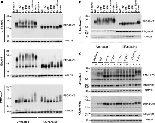 Figure 5. Biochemical properties of IFN-γR2 after various chemical treatments. (A) HEK293T cells were transiently transfected with 278delAG, WT, R114C, S124F, G141R, G227R, 382-387dup, and T168N IFNGR2-tagged V5 constructs. They were then incubated alone or with 166 μM kifunensine for 48 hours. Whole cell extracts were generated and left untreated or digested with Endo-H and PNGaseF overnight at 37°C. They were then subjected to sodium dodecyl sulfate-polyacrylamide gel electrophoresis and immunoblotting with antibodies against V5 and glyceraldehyde-3-phosphate dehydrogenase. (B-C) Cell surface expression of IFN-γR2 was evaluated in a surface biotinylation assay in SV40 fibroblasts from the IFN-γR2–deficient patient (278delAG/278delAG) transfected with 278delAG, WT, S124F, R114C, G141R, G227R, 382-387dup, and T168N IFNGR2-tagged V5 constructs. These cells were then incubated alone or with 166 μM kifunensine for 48 hours. (B) Surface receptors isolated by precipitation with NeutroAvidin agarose beads. (C) Total extracts (T) or flow-through (F) fractions were immunoblotted with antibodies against V5, integrin β1, and glyceraldehyde-3-phosphate dehydrogenase.