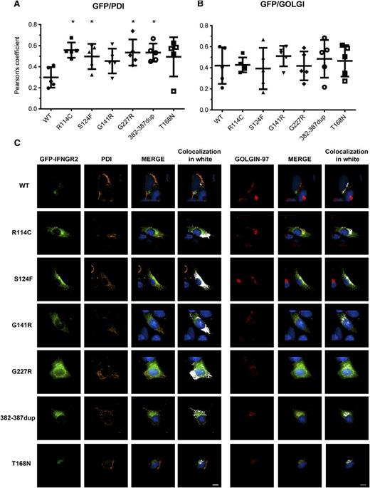 Figure 6. Subcellular localization of mutant IFN-γR2 proteins. SV40 fibroblasts from the IFN-γR2–deficient patient (278delAG/278delAG) were transiently transfected for 48 hours with WT, S124F, R114C, G141R, G227R, 382-387dup, and T168N IFNGR2-tagged EGFP constructs. Cells were fixed and permeabilized, and intracellular double staining with PDI (orange) and golgin-97 (red) was performed. Images were acquired with DeltaVision Image Restoration Microscope with the 60× objective. Colocalization of GFP with (A) PDI and (B) golgin-97 was measured as Pearson’s coefficients in dataset volumes. The values shown are the mean ± standard deviation of 5 cells analyzed. Differences between WT and each mutant were analyzed using the Student t test. P < .05 was considered significant and is indicated by an asterisk. (C) Colocalization of WT and mutant proteins with PDI or golgin-97 were visualized by merging the images, and then a colocalization channel was created using IMARIS software. Colocalized pixels are show in white. Nuclei were stained with 4,6 diamidino-2-phenylindole (blue). Scale bars, 5 μm.