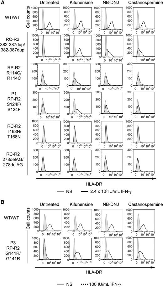 Figure 7. Chemical complementation with kifunensine of the response of the patients’ SV40 fibroblasts to IFN-γ. SV40 fibroblasts from a healthy control (WT/WT), 2 patients with recessive complete IFN-γR2 deficiency with detectable surface expression of a nonfunctional IFN-γR2 (RC-R2, 382-387dup/382-387dup and RC-R2-T168N/T168N), a patient with recessive partial IFN-γR2 deficiency (RP-R2, R114C/R114C), patient P1 with the S124F mutation (RP-R2, S124F/S124F), patient P3 with the G141R mutation (RP-R2, G141R/G141R), and a patient with recessive complete IFN-γR2 deficiency and no expression of the receptor at the cell surface (RC-R2, 278delAG/278delAG) were incubated for 72 hours in complete culture medium without (gray filled) stimulation, or with (A) 2.4 × 104 IU/mL IFN-γ (bold line) or (B) 100 IU/mL IFN-γ (dashed line) with or without 1.5 mM NB-DNJ, 2 mM castanospermine, or 160 μM kifunensine. They were analyzed 48 hours later. The surface expression of HLA-DR molecules was determined by flow cytometry with a specific antibody.