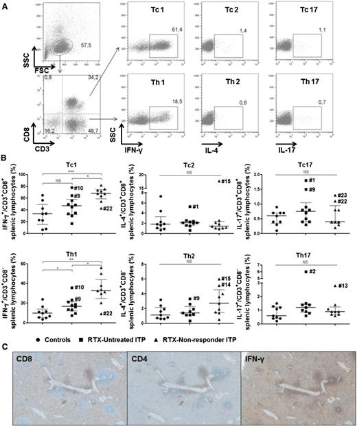 Figure 3. Splenic T-cell commitment. Splenocytes were stimulated with PMA and ionomycin in the presence of Brefeldin A for 4 hours. Cells were first stained for CD3 and CD8. After fixation and permeabilization, intracellular staining for IFN-γ, IL-4, and IL-17 was performed. (A) For FCM analyses, lymphocytes were first gated on their forward (FSC) and side scatter (SSC), then on their expression for CD3 and CD8. Cells were defined as Tc1: CD3+CD8+IFN-γ+, Tc2: CD3+CD8+IL-4+, Tc17: CD3+CD8+IL-17+, Th1: CD3+CD8−IFN-γ+, Th2: CD3+CD8−IL-4+, and Th17: CD3+CD8−IL-17+. The results of a representative RTX-nonresponder patient are depicted. (B) Data are summarized in dot plots representing the expression of each cytokine among T cells, in 9 controls (black circles), 10 RTX-untreated patients (black squares), and 9 RTX nonresponders (black triangles). The horizontal bar represents the median with the interquartile range. P values were derived by Mann-Whitney U test. *P < .05; **P < .01; ***P < .001. NS, nonsignificant. (C) IFN-γ–producing cells were located within periarteriolar lymphoid sheath (PALS) and in the red pulp and consist of CD8+ and CD4+ T cells (CD8, CD4, and IFN-γ staining, DAB, magnification ×400). Representative immunohistochemistry of 1 RTX-untreated ITP patient.