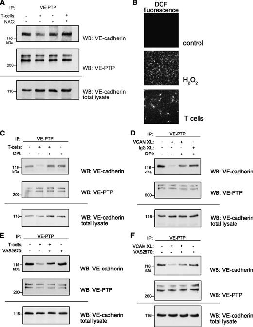 Figure 3. Endothelial ROS production induces VE-cadherin/VE-PTP dissociation. (A) Scavenging of ROS inhibits T-cell–induced VE-cadherin/VE-PTP dissociation. Preincubation of TNF-α–stimulated bEnd.5 cells with or without the ROS scavenger NAC (1 mM) (as indicated above) was followed by incubation with T cells and subsequent VE-PTP/VE-cadherin coimmunoprecipitation analysis. (B) T-cell adhesion induces ROS production in endothelial cells. TNF-α–stimulated bEnd.5 cells were loaded with the fluorescent ROS indicator DCF and were subsequently incubated either with H2O2 (as a positive control) or with T cells, followed by recording intracellular fluorescence. (C) Inhibition of ROS production prevents VE-cadherin/VE-PTP dissociation. TNF-α–stimulated bEnd.5 cells were pretreated with 2 μM of the flavoprotein inhibitor DPI, followed by incubation with or without T cells and subsequent VE-PTP/VE-cadherin coimmunoprecipitation analysis. (D) The same process was done as in panel C, but bEnd.5 cells were stimulated with anti-VCAM-1–loaded beads (VCAM XL) instead of T cells. (E) NOX inhibition prevents VE-cadherin/VE-PTP dissociation. TNF-α–stimulated bEnd.5 cells were preincubated with the specific NOX inhibitor VAS2870 (10 μM) and were subsequently analyzed as was done in panel C. (F) NOX inhibition prevents VE-cadherin/VE-PTP dissociation in murine primary lung endothelial cells. TNF-α–stimulated cells were pretreated with 10 μM of the VAS2870 NOX inhibitor, followed by stimulation with anti-VCAM-1–loaded beads (VCAM XL) and subsequent VE-PTP/VE-cadherin coimmunoprecipitation analysis.