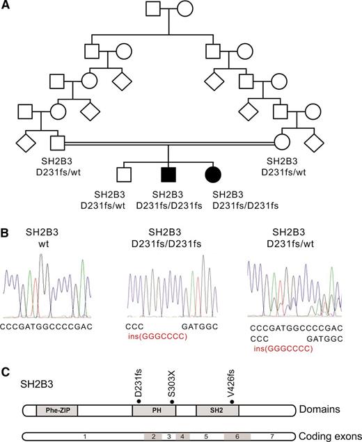 Figure 1. Identification of a SH2B3 mutation in a familial autoimmunity and acute leukemia kindred. (A) Family pedigree. Affected individuals are shaded in black. (B) DNA sequencing chromatograms showing the SH2B3 D231fs mutation in the proband and a heterozygous carrier compared with a control SH2B3 wild-type DNA sample. (C) Schematic representation of the structure of the SH2B3 protein. The phenylalanine zipper (Phe-ZIP), the Plekstrin homology domain (PH), and the Scr Homology 2 domains (SH2) are indicated. The SH2B3 D231fs mutation identified in this family and somatic SH2B3 mutations found in ALL patient samples are shown.