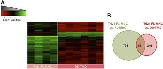 Figure 3. Acquisition of GATA1 mutations is accompanied by a wave of hypermethylation changes at distinct loci. (A) Heatmap representation of differentially methylated regions between Tri21 FL-MNC and DS-TMD blasts. Each row represents a genomic region, and each column represents a patient sample. (B) Venn diagram representation of the overlap between the Tr1 FL-MNC vs control FL-MNC DMRs and the Tri21 FL-MNC vs DS-TMD DMRs.