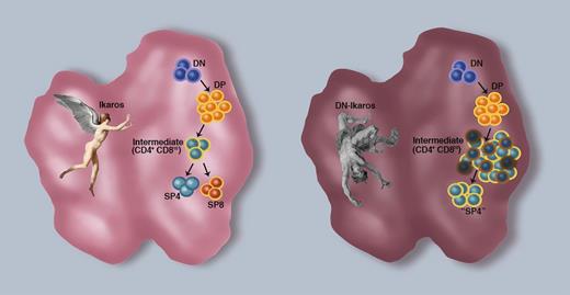 Ikaros rescue of positively selected thymocytes. T-cell differentiation requires that hematopoietic progenitors migrate from the bone marrow into the thymus. Early progenitors express neither the CD4 nor the CD8 coreceptor and are therefore termed double-negative (DN) thymocytes. On commitment to the T-cell lineage, the developing thymocytes acquire CD4 and CD8 expression and are termed double-positive (DP) thymocytes. Those DP thymocytes that are signaled via their TCR become intermediate (CD4+CD8lo) cells that can then differentiate to mature single positive CD4 (SP4) or CD8 (SP8) thymocytes. Tinsley et al1 identify Ikaros as a critical factor in the survival and differentiation of these intermediate thymocytes to a mature SP fate (left thymus). Under conditions where a dominant negative Ikaros (DN-Ikaros) is expressed, suppressing the function of all Ikaros family members, there is a concomitant proliferation and apoptosis of these intermediate thymocytes, inhibiting further differentiation and driving the clonal expansion of these semimature cells. Ikaros in flight (left thymus) and in fall (right thymus) are from Charles Paul Landon’s painting of Dedalus and Icarus (1799; Musée des Beaux-Arts et de la Dentelle, Alençon, France) and Peter Paul Rubens’ painting of The fall of Icarus (Musées Royaux Des Beaux-Arts, Brussels, Belgium), respectively. Figure design by Sandrina Kinet, Institut de Génétique Moléculaire de Montpellier, France. Professional illustration by Marie Dauenheimer.