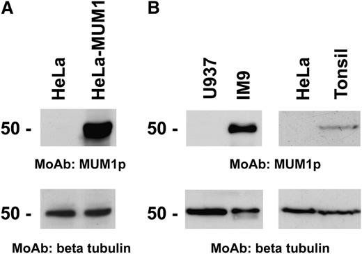 Figure 1. Western blotting with the MUM1p monoclonal antibody. (A) A band of ∼50-kd of the expected size of MUM1-myc protein is seen in the line corresponding to pCEP4-MUM1-myc HeLa-transfected cells (HeLa-MUM1) but not in negative control HeLa cells. Tubulin levels are shown below as control for the amount of the loaded protein. (B) A 50-kd band of the expected molecular size of the MUM1 protein is seen in lanes 2 and 4, corresponding to the IM9 myeloma cell line and normal tonsil. No bands are detected in lanes 1 and 3, corresponding to U937 and HeLa cell lines. Identical results (not shown) were obtained with the monoclonal (clone MUM97) and polyclonal anti-IRF4/ICSAT antibody. In both experiments, β-tubulin levels are shown below to control for the integrity and amount of the loaded protein.
