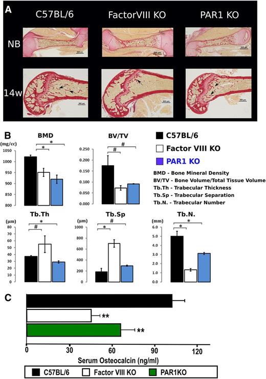Figure 6. Aberrant bone structure in FVIIIKO and PAR1KO mice. (A) Bone connective tissue staining with sirius red for collagen synthesis is depicted. C57BL, FVIIIKO and PAR1KO are shown, respectively, at NB and 14 weeks of age. Arrows point to diminished amount of trabeculae in FVIIIKO and PAR1KO mice compared with C57BL control. NB, newborn. (B) Quantification of the structural parameters of the tibial metaphysis such as BMD, BV:TV, Tb.N, Tb.Th, and Tb.Sp. in C57BL (black), FVIIIKO (white), and PAR1KO (blue) are shown graphically. Graphs show mean value ± SD (#P < .001; *P < .05, n = 4/group). (C) Quantification of serum osteocalcin measured by ELISA. C57BL (black), FVIIIKO (white), and PAR1KO (green) are shown. Bars depict mean value ± SD (**P < .05, n = 10 per group).