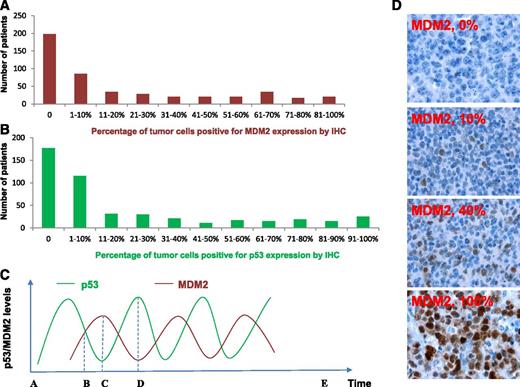 Figure 1. MDM2 and p53 expression in DLBCL patients treated with R-CHOP. (A-B) Histogram showing the distribution of MDM2 and p53 expression levels in the DLBCL cohort. X-axis, percentage of immunopositive cells in tumors; Y-axis, numbers of DLBCL patients. (C) Illustration of p53 and MDM2 kinetic pulses in tumor cells under stress conditions. In a single cell, because of the fluctuating p53/MDM2 levels in oscillatory pulses, the IHC pattern is (1) p53–/MDM2– at zero time point A or E after cellular stress is removed; (2) p53+/MDM2+ at time point B; (3) p53–/MDM2+ at time point C; and (4) p53+/MDM2– at time point D. Same patterns over cell population may be generated by evaluation of the percentage of MDM2+ cells and defining overexpression by certain cutoffs. (D) Representative MDM2 immunohistochemical staining patterns.