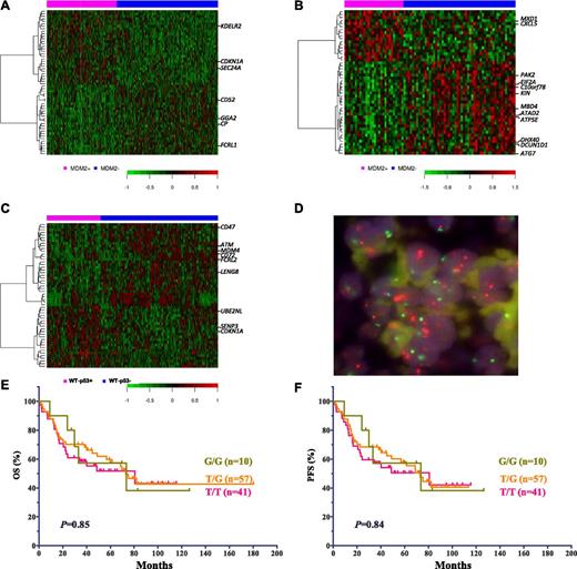 Figure 5. Comparison and characterization of differentially expressed genes in subgroups of DLBCL patients treated with R-CHOP. (A) DEGs in patients with MDM2+ and MDM2– DLBCL with WT-p53. (B) DEGs in patients with MDM2+ and MDM2– DLBCL with MUT-p53. (C) DEGs in patients with p53+ and p53– DLBCL with WT-p53. (D) MDM2 amplification shown by FISH. In every single cell, the orange signals (MDM2), by at least two times, outnumber the green signals (centromere 12). (E-F) Impact of MDM2 SNP309 on OS and PFS in DLBCL patients.