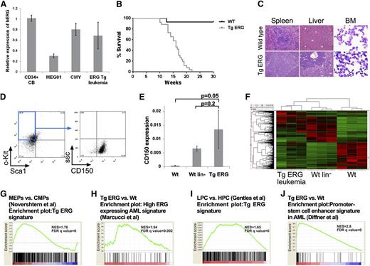 Figure 1. ERG induces an early progenitor myeloid leukemia in mice. (A) Bar graph depicting expression of human ERG by quantitative RT-PCR in TgERG leukemia and human AML cell lines MEG01 and CMY compared with normal CD34+ cells derived from cord blood (mean ± SEM, n = 3; experiment was repeated twice). (B) Kaplan-Meier survival curve showing that all transgenic ERG mice die by the age of 22 weeks (WT mice, n = 14; TgERG mice, n = 26). (C) Hematoxylin and eosin–stained sections of spleens and livers and Giemsa-stained cytospin samples from the bone marrow of TgERG mice and WT littermates (original magnification ×200 for sections, ×600 for cytospin samples). (D) Immunophenotype of TgERG leukemias. Typical dot plots showing that most of the bone marrow cells found in sick TgERG mice are lin–, cKit+ Sca-1– CD150+. (E) Validation of CD150 expression by quantitative RT-PCR normalized to β-actin (mean ± SEM, n = 3 for WT and WT lin–. N = 5 for TgERG leukemia). (F) Heat map depicting hierarchical clustering of TgERG leukemias and WT controls (see supplemental Methods). (G) GSEA showing enrichment of the TgERG leukemia signature in MEPs compared with CMPs.19 (H) GSEA showing enrichment of high ERG–expressing human AML signature9 in the TgERG leukemia compared with WT mice. (I) GSEA showing enrichment of TgERG leukemia signature in human AML progenitors compared with normal hematopoietic progenitors.20 (J) GSEA showing enrichment of the promoter-stem cell enhancer signature21 in TgERG leukemia compared with WT mice.