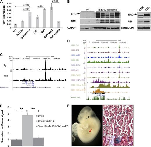 Figure 5. Pim1 is a direct ERG target activated by a +10 enhancer site. (A) Pim1 levels by quantitative RT-PCR in TgERG leukemia and mouse WT whole or lineage-negative bone marrow, in human CMK (low ERG) or CMY (high ERG) cells, and in CMY cells transfected with either nontargeting shRNA (shNT) or ERG (shERG) shRNA. (B, left panel) ERG and Pim1 protein levels in the bone marrow of TgERG leukemic mice and WT littermates; (right panel) ERG and PIM1 protein levels in CMK and CMY human AML cells. (C) Density plots showing ERG binding to Pim1 loci in 2 TgERG leukemias. (D) Density plots showing occupancy of the PIM1 loci in human CD34+ cells by a heptad of transcription factors and by open chromatin marks. (E) Luciferase reporter assay. The Pim1 +10 candidate regulatory region was cloned into a luciferase reporter plasmid and stably transfected to L8057 cells. Cells expressing the Pim1 +10 region showed a four to sixfold increase in promoter activity compared with the empty vector. Mutations in the 2 ETS motifs in the Pim1 +10 region nearly abolished its enhancing effect. (F) Transgenic reporter mice: The Pim1 +10 region was cloned into a lacZ reporter vector and used to generate transgenic F0 embryos. Typical images showing Xgal staining in fetal liver of E10.5 embryo in either whole embryo (left) or in fetal liver sections (right).