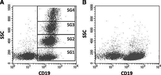 Figure 1. CLL clonal SGs revealed by bead-immobilized anti-sIgM separation. PBMCs were incubated either with goat F(ab’)2 anti-human IgM coated beads (A) or isotype control coated beads (B). CLL SGs were identified within the CD19+ tumor population according to different SSC in the FACS Calibur. A representative case (CLL4) is shown.