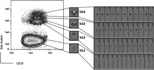 Figure 2. Flow cytometry-based imaging of single cells in CLL SGs. CLL SGs were identified within the live and singlet CD19+ population and selected for analysis (left) by the ImageStreamX. Random images of individual cells from CLL5 in SG1 (lower population) and the upper SGs are shown on the right.