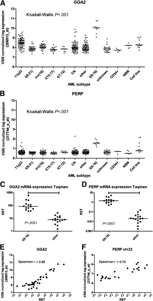 Figure 4. GGA2 and PERP mRNA expression. RET indicates relative expression measured by RT-qPCR. Shown is GGA2 and PERP mRNA expression levels of pediatric AML patient samples and AML cell lines. (A,B) Levels from GEP for GGA2 and PERP, respectively. (C,D) Levels as determined by RT-qPCR. (E,F) show the correlation between both RT-qPCR and GEP.