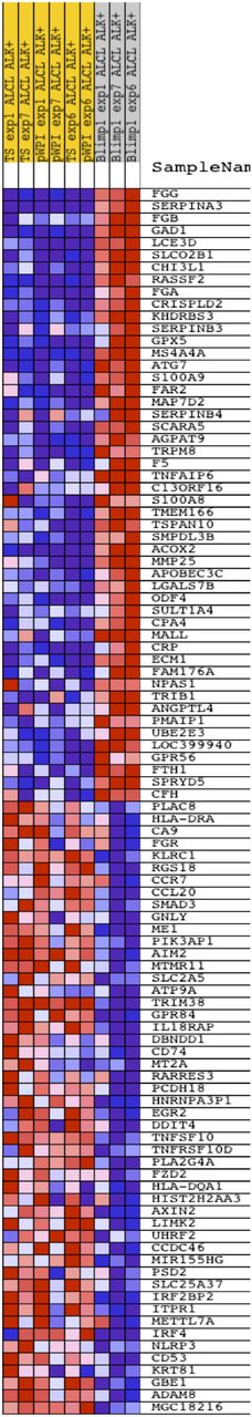 Figure 4. Hierarchical clustering of samples analyzed with GEP. GEP analysis was performed in untreated Supm2-TS cells (n = 3), Supm2-TS cells 72 hours after infection with empty vector (pWPI; n = 3) and Supm2-TS cells after infection with lentivirus for BLIMP1 reconstitution (pWPI-HA-BLIMP1; n = 3).