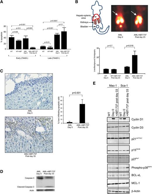 Figure 3. ABT-737 treatment-induced apoptosis of AML cells in the liver and the spleen of the mice, despite persistence of BCL-2 in the RAS-GTP complex and relocalization of the RAS:BCL-2 complex. (A) Histogram of mean ± standard deviation (SD) showing an increase of late/necrotic apoptotic cells (n = 3). (B) Paired untreated and treated radioisotope heat maps of 99mTc labeled annexin-V, which targets apoptotic cells and is metabolized in the kidney and bladder, shows greater intensity around the location of the liver in the pretreated AML mouse (day 0, n = 6), which is increased after day 23 (postday 23) after 10 injections. Histogram of mean ± SD showing an increase of apoptotic cells in AML mice after treatment (n = 5 mice), whereas WT mice do not show a significant increase in uptake of the label (WT, n = 14 untreated and n = 3 treated). (C) Representative DNA fragmentation as demonstrated by TUNEL-positive myeloid cells is significantly greater (postday 33) in the liver of mice; histogram of untreated and treated AML mice (mean ± SD of n = 4). (D) Representative western blot of spleen cells of AML mice probed with anti-caspase 3 antibody showing untreated (day 0) and caspase 3-mediated cleavage after treatment (postday 33) with reprobing with anti-βactin antibody showing protein loading. Results are representative of 3 mice. (E) Representative western blot of protein lysates from Mac-1+ and Sca-1+ enriched spleen cells of normal WT, AML untreated (day 0), and ABT-737 treated (postday 33) mice immunoprobed with cyclin D1 and D3, p21Waf1/Cip1, p15INK4B, p27Kip1, phospho-p38MAPK, BCL-xL, MCL-1, and β-actin (control for loading) (n = 2 mice).