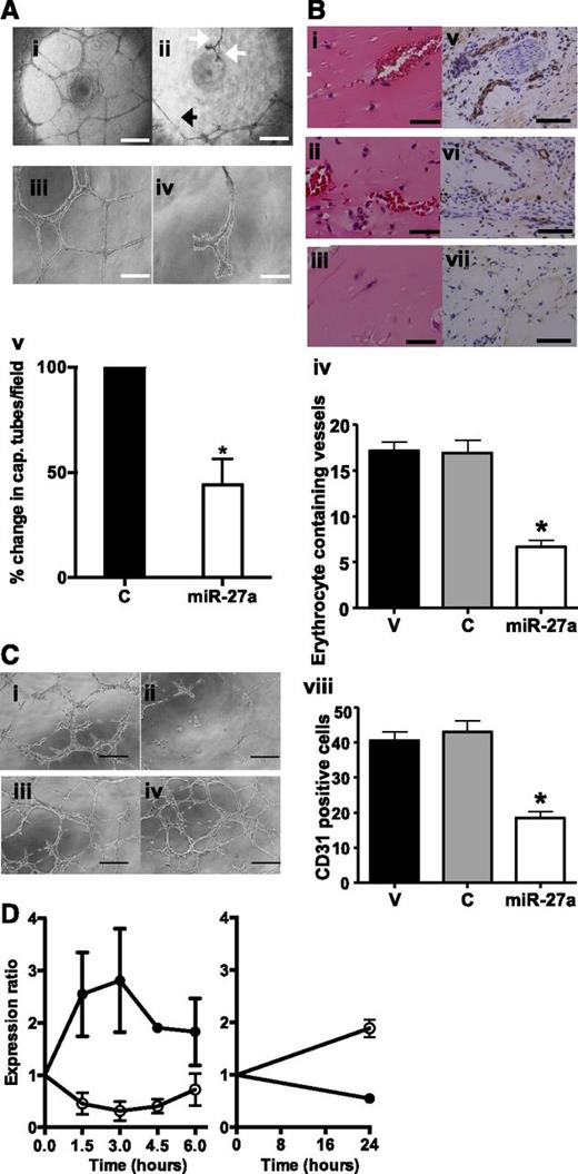 Figure 3. Regulation of angiogenesis and vascular leak by miR-27. (A) HUVEC transfected with control (i and iii) or miR-27a mimic (ii and iv) and plated onto Matrigel. The retracted tubes are represented by a white arrow. The very thin tubes are represented by a black arrow. (i-ii) The scale bar indicates 200 µm. (iii-iv) The scale bar indicates 400 µm. (v) Number of capillary tubes formed per field of view, expressed as a percent relative to the control. *P < .05 cf control, n = 4 independent HUVEC lines, mean ± SEM. (B) Mice were implanted subcutaneously with Matrigel plugs containing fibroblast growth factor-2 and vehicle only (i,v), control (ii,vi), or miRNA-27a mimic (iii,vii). (i-iii) Representative histologic sections and hematoxylin and eosin–stained cross sections; the scale bar indicates 20 µm. (iv) Number of erythrocyte-containing vessels quantified. (v-vii) Representative CD31 immunochemistry. The scale bar indicates 50 µm. (viii) Number of CD31+ cells quantified. Data are expressed as mean ± SEM. Statistical analysis of differences was compared by 1-way analysis of variance with Bonferroni’s correction for multiple comparisons. Control (C) represents n = 3 mice and miRNA-27a and vehicle (V) represent n = 6 mice. (C) Reversal of the effect of miR-27a-mimics by overexpression of VE-cadherin. Cells were transfected with control mimic (i), miR-27a mimics (ii), VE-cadherin plasmid + control mimics (iii), or VE-cadherin expression plasmid + miR-27a-mimics (iv). 24 hours later, the cells were plated onto Matrigel and viewed over the following 24 hours. (D) Expression of miRNA-27a (open circles) and mRNA for VE cadherin (closed circles) over time after wounding monolayers of EC. Data are normalized to levels in the confluent cells. Expression levels were measured by qRT-PCR, with the results of miR-27a normalized to U48 and VE-cadherin normalized to β-actin. Results are from 2 to 4 independent HUVEC lines.