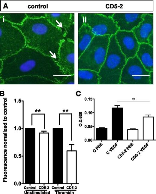 Figure 5. Blockmirs regulate VE-cadherin–dependent functions. (A) HUVECs were stained for VE-cadherin 48 hours after transfection. (i) Control or (ii) CD5-2. White arrows indicate intercellular gaps. (B) Cells were transfected with control or CD5-2, and permeability was assessed through unstimulated or thrombin-stimulated monolayers. Results are normalized to permeability of control (n = 1). The mean ± SEM of 3 to 5 experiments is shown. **P < .005. (C) The Miles assay was performed in mice with control (black bars) or CD5-2 (white bars) injected intravenously. 24 hours later, VEGF or phosphate-buffered saline was given intradermally (n = 4 mice per group). **P < .005.