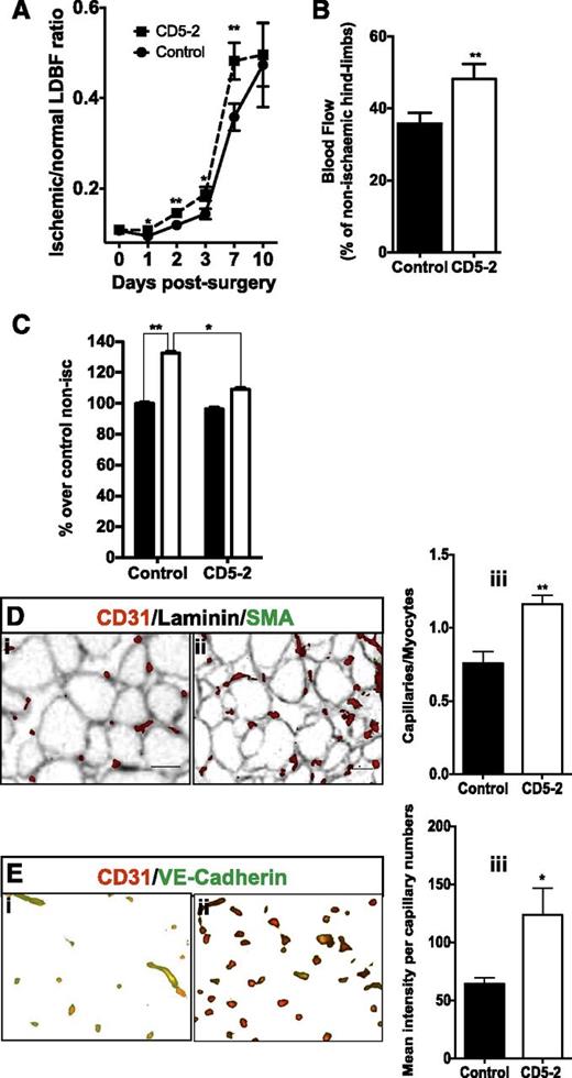 Figure 6. Blockmirs regulate edema and angiogenesis after ischemia. (A) Hindlimb blood flow expressed as a percentage of ischemic limb blood flow over nonischemic hindlimb blood flow measured 10 days after surgery. **P < .01 (n = 6-10 mice per group). The LDBF between days 0 and 7, representing the mean of 3 independent experiments. (B) The ischemic LDBF of control and CD5-2 at day 7 is represented as a percentage over non-ischemic hind-limb blood flow. CD5-2 is represented by dashed lines; controls are represented by solid lines. (C) Assessment of edema 24 hours after hindlimb ischemia for mice treated with control Blockmir (black bars, nonischemic) and CD5-2 (white bars, ischemic). The graph is expressed as a percentage of dye leakage in either the nonischemic or ischemic side of control and CD5-2–treated mice over dye leakage in nonischemic controls. The lower part of adductor muscle was taken for quantification *P < .05, **P < .01 (n = 8 per group, results pooled from 2 independent experiments). (D) Assessment of capillary density. Sections were stained for CD31. A representative area is shown for one mouse given (i) control and (ii) CD5-2. (iii) Quantification of the number of capillaries is given as the ratio of capillaries/myocytes in the ischemic limbs (n = 4-5 animals), *P < .02. (E) Sections were co-stained with CD31 (red) and VE-cadherin (green). A representative area of the ischemic region is shown for one mouse given (i) control and (ii) CD5-2. (iii) Mean pixel intensity of VE-cadherin is expressed relative to the number of capillaries, which are CD31+ (n = 4 animals), *P < .05.