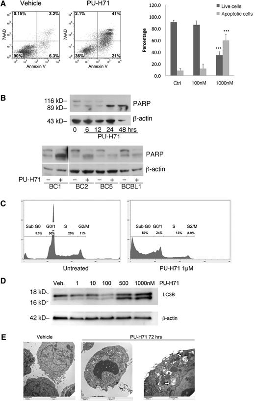 Figure 3. PU-H71 induces PEL cell death by apoptosis and autophagy. (A) BC3 cells treated with 1 µM PU-H71 for 72 hours were examined by flow cytometry after staining for 7-AAD and Annexin V. Results were quantified into percentages of live and apoptotic cells (Annexin V positive). ***Statistical significance of P < .001 as compared with the control (untreated) group. (B) Top: Immunoblot analysis using extracts from BC3 cells treated at the indicated time points with 2 µM PU-H71 for the indicated time points shows PARP cleavage by 24 hours as indication of apoptosis. Lower: PARP cleavage is apparent after PU-H71 treatment (2 μM for 24 hours) in additional PEL cell lines. (C) BC3 cells treated with 1 µM PU-H71 for 72 hours were examined by flow cytometry for DNA content cell-cycle analysis. Only the Sub-G0 fraction, indicative of apoptosis, was found to increase in treated cells. (D) Autophagy induction was examined by immunoblot of PU-H71–treated cells. Appearance of the cleavage product of LC3B is indicative of autophagy. (E) BC3 cells treated with 1 µM PU-H71 were examined for the appearance of autophagosomes containing degraded cellular organelles using electron microscopy. Autophagosomes are clearly visible in the right panel at higher magnification (arrows).