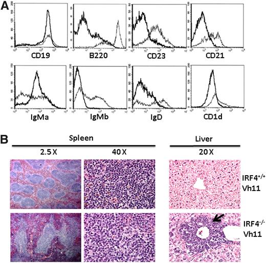 Figure 2. Phenotypic and histologic analyses of CLL cells in the IRF4−/−Vh11 mice. (A) Splenocytes from IRF4+/+ Vh11 and IRF4−/−Vh11 mice were stained with antibodies against CD19, B220, IgMa, IgMb, CD21, CD23, IgD, and CD1d. The stained cells were analyzed by FACS. The data were presented as a histogram under a B-cell gate. Dark line, IRF4−/− Vh11 CLL cells; light line, IRF4+/+ Vh11 B cells. (B) Spleens and livers were isolated from 5-month-old IRF4−/−Vh11 and IRF4+/+Vh11 mice. The tissues were fixed, sectioned, stained with H&E. The spleen sections are shown at ×2.5 and ×40; the liver sections are shown at ×20. Arrow indicates the infiltrated CLL cells in liver.