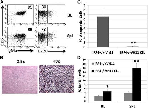Figure 4. IRF4−/−Vh11 CLL cells are transplantable in immunodeficient host mice. CLL cells were isolated from spleens of IRF4−/− Vh11 mice and transplanted into Rag2−/−γ−/− mice. A total of 106 CLL cells was used for each injection. Three weeks after transplantation, the mice were analyzed. (A) Blood and spleen of the host mice were analyzed by FACS. (B) H&E staining of spleen of transplanted host mice. (C) CLL cells were isolated from spleens of host mice. TUNEL assay was used to detect apoptotic cells. Splenic B cells from IRF4+/+Vh11 mice were analyzed as control. (D) Host mice were pulse-labeled with BrdU and examined 12 hours later. BrdU+ cells in blood and spleen of IRF4+/+Vh11 mice were also examined and used as control. *P < .05; **P < .01.
