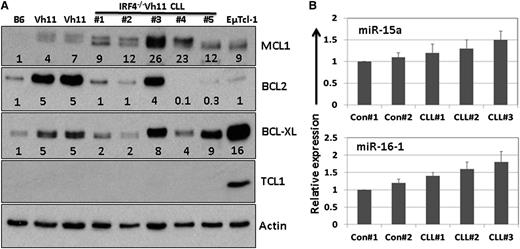 Figure 5. Molecular characterization of IRF4−/−Vh11 CLL cells. (A) Splenic CLL cells were isolated from 5 IRF4−/−Vh11 mice via negative selection and lysed for western blot analysis with indicated antibodies. Splenic B cells from IRF4+/+Vh11(Vh11) and IRF4+/+ (B6) mice were also isolated and analyzed as controls. Additionally, splenic CLL cells from EµTcl1 transgenic mice were used as positive control for Tcl-1 expression. The numbers below each lane indicate the fold change in comparison with the control. The intensity of each protein was normalized initially to β-actin. (B) Total RNA was also extracted from the isolated cells. Real-time TaqMan polymerase chain reaction to detect expression of miR15a/16-1 was done using a kit from Applied Biosystems. The data were normalized to U6 spliceosomal RNA and were expressed as fold change in comparison with controls (IRF4+/+Vh11).