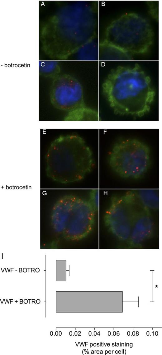 Figure 1. VWF active conformation enhances endocytosis by macrophage. (A-H) wt-rVWF (5 μg/mL) was perfused over PMA-stimulated THP-1 macrophages in the absence (A-D) or presence (E-H) of botrocetin (1.6 U/mL). Perfusion was performed for 15 minutes at 5 dynes/cm2. Nuclei were stained with 4,6-diamidino-2-phenylindole (blue), actin was stained with AlexaFluor 488–conjugated phalloidin (green), and VWF was detected with primary rabbit anti-human VWF antibody followed by tetramethyl rhodamine iso-thiocyanate–conjugated goat anti-rat IgG antibody (red). Original magnification is ×100. (I) VWF internalization was quantified with ImageJ as the percentage of surface covered by red spots (VWF staining) per number of cells per field. Data represent mean ± SEM. *P < .05.